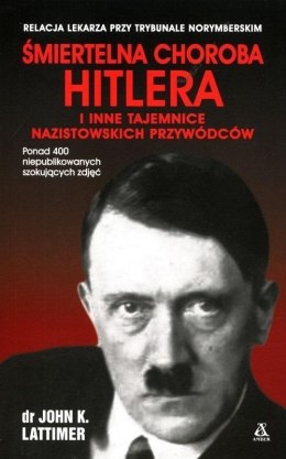 Śmiertelna choroba Hitlera i inne tajemnice..
