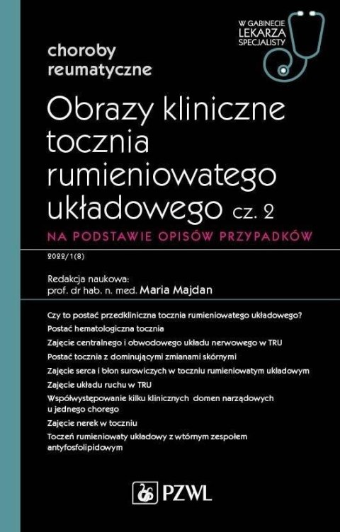 Obrazy kliniczne tocznia rumieniowatego układ cz.2