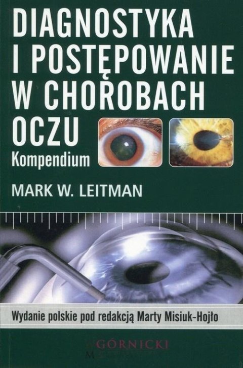 Diagnostyka i postępowanie w chorobach oczu...