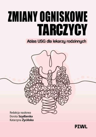 Zmiany ogniskowe tarczycy. Atlas USG dla lekarzy..